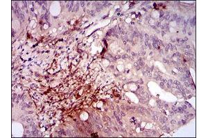 Immunohistochemistry (IHC) image for anti-Integrin-Linked Kinase (ILK) (AA 97-244) antibody (ABIN1098122)