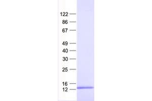 Validation with Western Blot (RPL31 Protein (His tag))