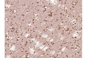 Paraformaldehyde-fixed, paraffin embedded Human brain glioma Antigen retrieval by boiling in sodium citrate buffer (pH6. (STAT1 antibody)