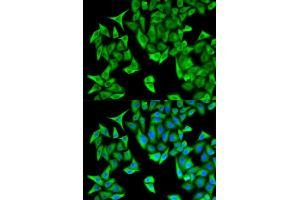 Immunofluorescence analysis of HeLa cells using PSMD9 antibody (ABIN5973093). (PSMD9 antibody)