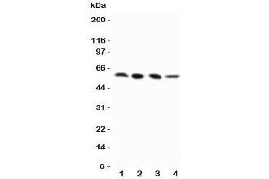 Western blot testing of RIP3 antibody and Lane 1:  PANC;  2: SW620;  3: SKOV-3;  4: M231 cell lysate (MPRIP antibody  (N-Term))