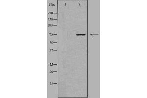 Western blot analysis of extracts from HT-29 cells, using ACS2L antibody. (ACSS1 antibody  (C-Term))