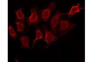 ABIN6268917 staining sw480 cells by IF/ICC. (KRT14 antibody  (N-Term))