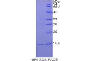 SDS-PAGE analysis of Rat REG3G Protein. (REG3g Protein)