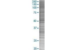 KRR1 transfected lysate. (KRR1 293T Cell Transient Overexpression Lysate(Denatured))