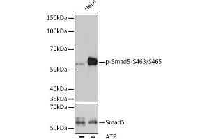 Western blot analysis of extracts of HeLa cells, using Phospho-Smad5-S463/S465 antibody (ABIN7270353) at 1:1000 dilution or Smad5 antibody (ABIN3022683, ABIN3022684, ABIN3022685 and ABIN6219095). (SMAD5 antibody  (pSer463, pSer465))