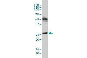 MGC10540 monoclonal antibody (M01A), clone 2E5-2B9 Western Blot analysis of MGC10540 expression in Hela S3 NE . (VPS25 antibody  (AA 1-176))