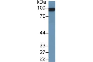 Western blot analysis of Rat Uterus lysate, using Rat MCAM Antibody (1 µg/ml) and HRP-conjugated Goat Anti-Rabbit antibody ( (MCAM antibody  (AA 323-560))