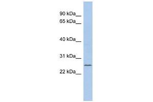 C11ORF53 antibody used at 1 ug/ml to detect target protein. (C11orf53 Antikörper  (Middle Region))