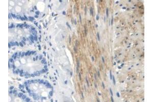 DAB staining on IHC-P; Samples: Rat Small intestine Tissue (TLR5 antibody  (AA 325-644))