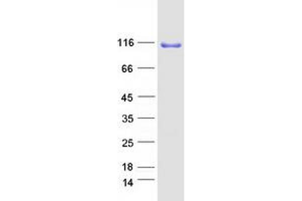 OGT Protein (Transcript Variant 1) (Myc-DYKDDDDK Tag)