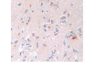 DAB staining on IHC-P; Samples: Human Brain Tissue. (BNP antibody)