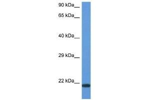 Western Blot showing CD70 antibody used at a concentration of 1 ug/ml against ACHN Cell Lysate (CD70 antibody  (N-Term))
