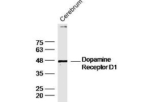 Mouse cerebrum lysates probed with DRD1 Polyclonal Antibody, unconjugated  at 1:300 overnight at 4°C followed by a conjugated secondary antibody at 1:10000 for 90 minutes at 37°C. (Dopamine Receptor d1 antibody  (AA 101-200))