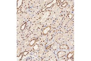 Immunohistochemistry of paraffin embedded human kidney using PAX2 (ABIN7074974) at dilution of 1:1000 (200x lens) (PAX2A antibody)