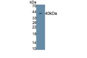 Detection of Recombinant CDH5, Rat using Monoclonal Antibody to Cadherin 5 (CDH5) (Cadherin 5 antibody  (AA 59-382))