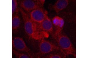 Immunofluorescence (IF) image for anti-VEGF Receptor 2 (VEGFR2) (pTyr1175) antibody (ABIN1870314) (VEGFR2/CD309 antibody  (pTyr1175))