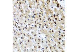 Immunohistochemistry of paraffin-embedded human liver injury using RAD23B antibody. (RAD23B antibody  (AA 50-150))