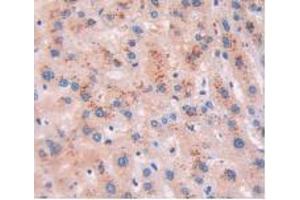 DAB staining on IHC-P; Samples: Human Liver Tissue. (BNP antibody)