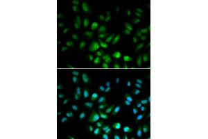 Immunofluorescence analysis of MCF-7 cells using USF1 antibody (ABIN5970877). (USF1 antibody)