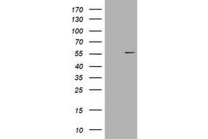 Image no. 1 for anti-Vimentin (VIM) (AA 210-466) antibody (ABIN1491203) (Vimentin antibody  (AA 210-466))