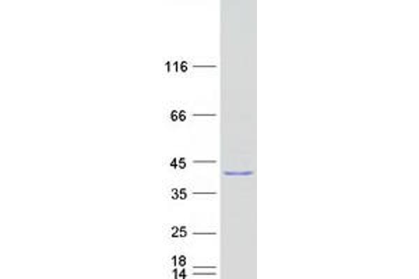 BCKDHB Protein (Transcript Variant 1) (Myc-DYKDDDDK Tag)