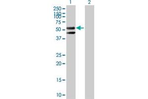 Western Blot analysis of CPM expression in transfected 293T cell line by CPM MaxPab polyclonal antibody. (CPM antibody  (AA 1-443))