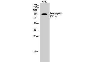 Western Blotting (WB) image for anti-Tumor Protein P73 (TP73) (acLys321) antibody (ABIN3172842) (Tumor Protein p73 antibody  (acLys321))