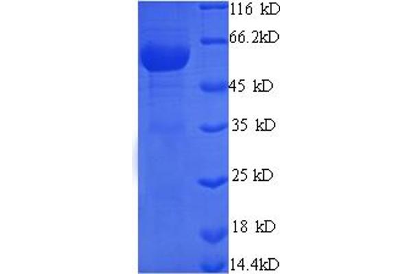 Monoamine Oxidase B Protein (MAOB) (AA 2-489, Cytoplasmic Domain, Cytosolic) (His tag)