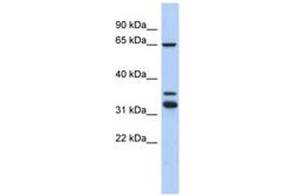 S100PBP antibody  (C-Term)