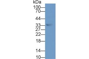 Detection of TWSG1 in Human Urine using Polyclonal Antibody to Twisted Gastrulation Protein Homolog 1 (TWSG1) (TWSG1 antibody  (AA 26-223))