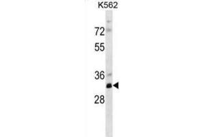 Western Blotting (WB) image for anti-phosphoribosyl Pyrophosphate Synthetase 2 (PRPS2) antibody (ABIN2998735) (PRPS2 antibody)