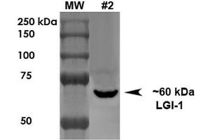 Western Blot analysis of Rat Brain Membrane showing detection of ~60 kDa LGI1 protein using Mouse Anti-LGI1 Monoclonal Antibody, Clone S283-7 . (LGI1 antibody  (AA 37-113))