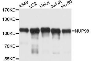 Western blot analysis of extracts of various cell lines, using NUP98 antibody. (NUP98 antibody)
