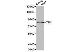 Western Blotting (WB) image for anti-TANK-Binding Kinase 1 (TBK1) antibody (ABIN1875027) (TBK1 antibody)