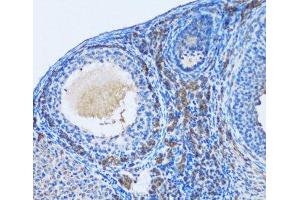 Immunohistochemistry of paraffin-embedded Rat ovary using OGDH Polyclonal Antibody at dilution of 1:100 (20x lens). (alpha KGDHC antibody)