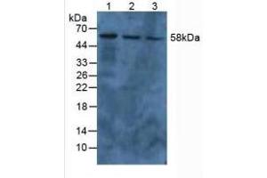 Western Blotting (WB) image for Pyruvate Kinase M2 (PKM2) ELISA Kit (ABIN6574169)