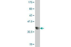 Western Blot detection against Immunogen (37. (GOLM1 antibody  (AA 302-401))