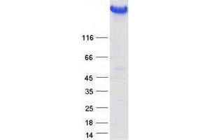 Validation with Western Blot (Thyroglobulin Protein (TG) (Myc-DYKDDDDK Tag))