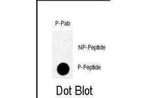 Dot blot analysis of anti-Phospho-TBK-p Antibody (ABIN390010 and ABIN2839780) on nitrocellulose membrane. (TBK (pSer172) antibody)