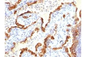 Immunohistochemistry (Formalin-fixed Paraffin-embedded Sections) (IHC (fp)) image for anti-Keratin 18 (KRT18) antibody (ABIN3026955)