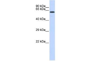 WB Suggested Anti-JMJD4 Antibody Titration:  0. (JMJD4 antibody  (N-Term))