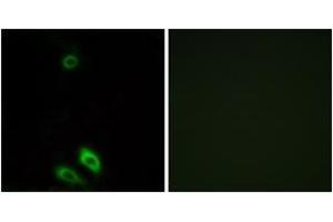 Immunofluorescence analysis of A549 cells, using AKR1CL1 Antibody. (AKR1CL1 antibody  (AA 80-129))