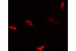 ABIN6274456 staining HT29 cells by IF/ICC. (DPF2 antibody  (Internal Region))