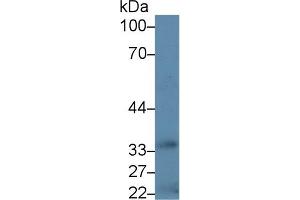 Western Blot; Sample: Human Liver lysate; Primary Ab: 5µg/ml Rabbit Anti-Human HSD17b1 Antibody Second Ab: 0. (HSD17B1 antibody  (AA 4-289))
