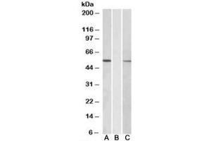Western blot of HEK293 lysate overexpressing human MGAT1-MYC probed with MGAT1 antibody [1ug/ml] in Lane A and anti-MYC [1/1000] in lane C. (MGAT1 antibody)