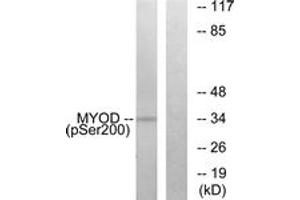 Western blot analysis of extracts from Jurkat cells treated with Ca+ 40nM 30', using MYOD (Phospho-Ser200) Antibody. (MYOD1 antibody  (pSer200))