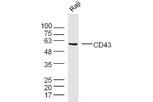 Raji cell lysates probed with CD43 Polyclonal Antibody, unconjugated  at 1:300 overnight at 4°C followed by a conjugated secondary antibody for 60 minutes at 37°C. (CD43 antibody  (AA 101-200))