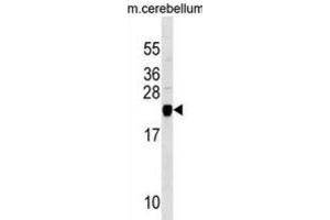 Western Blotting (WB) image for anti-Transgelin 3 (TAGLN3) antibody (ABIN3000208) (Transgelin 3 antibody)