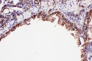 Immunohistochemistry (IHC) image for anti-Intercellular Adhesion Molecule 1 (ICAM1) (AA 198-537) antibody (ABIN3042515)